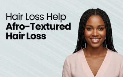 Afro Hair Loss: Causes, Prevention, and Treatment
