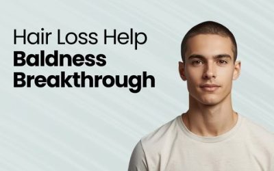 Baldness Breakthrough: Stem Cells Growing New Hair