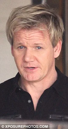 Gordon Ramsay with swollen face after hair transplant surgery