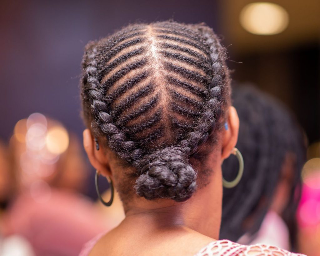 Hair braids can cause traction alopecia