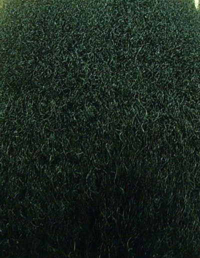 Mary after treatment — Female Pattern Balding