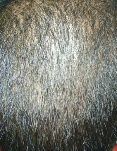 5 After Before