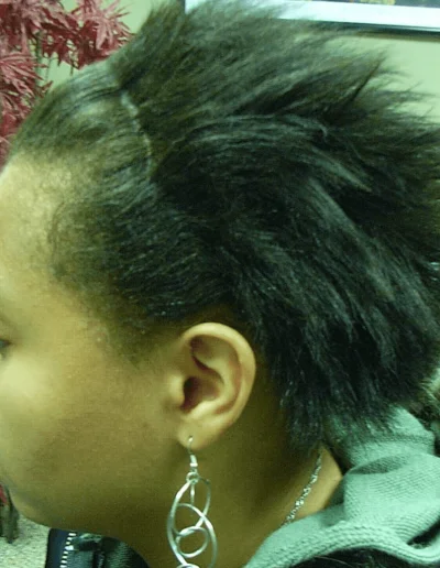 Black Hair Loss Weave Treated