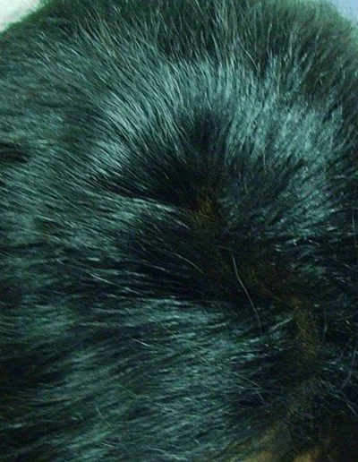 Anna Traction Alopecia — After
