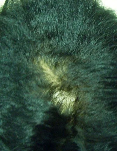 Anna Traction Alopecia — Before