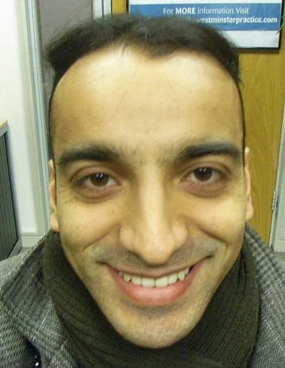 Happy Asim Post Male Asian Hair Treatment