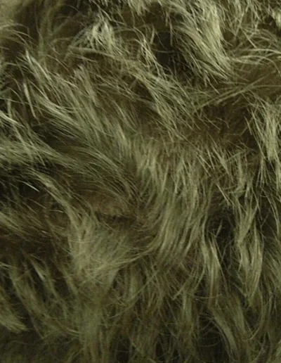 David Crown Hair Recovery — After