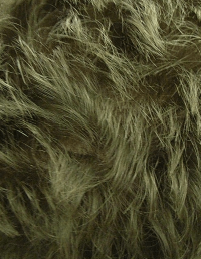 David Male Pattern Baldness — After