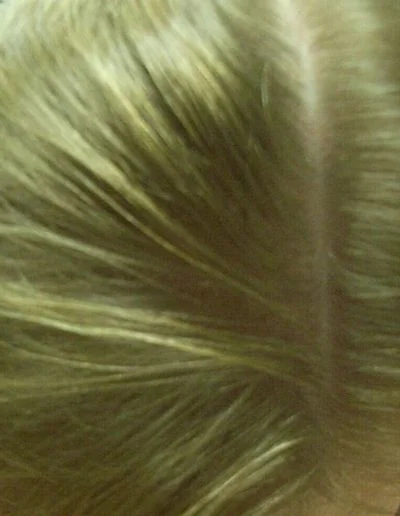 12 After