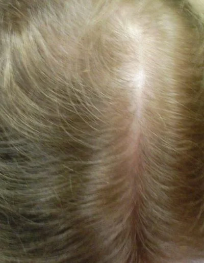12 After Before
