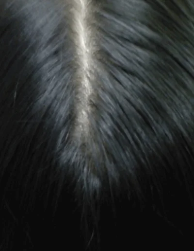 Asian Female 51 After