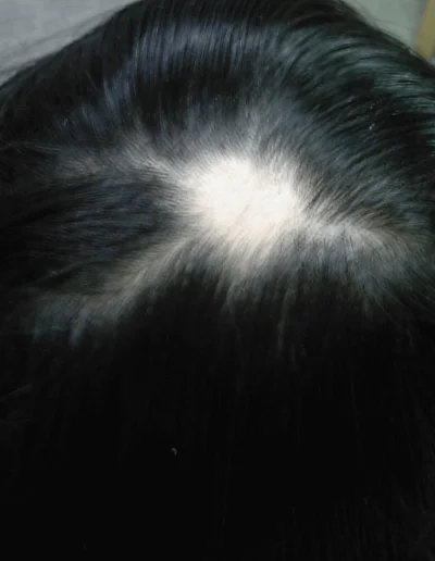 Asian Female 51 Before