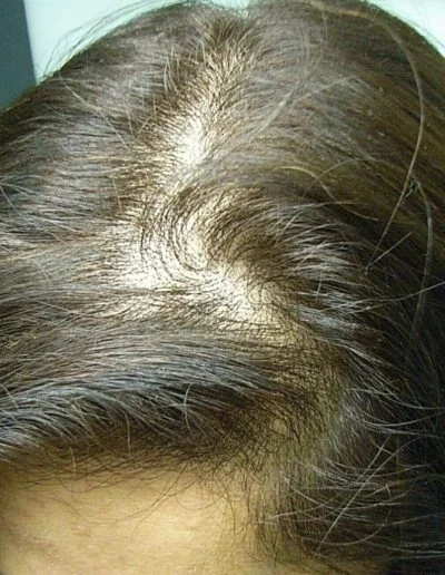 22 6 Beforeafter Before