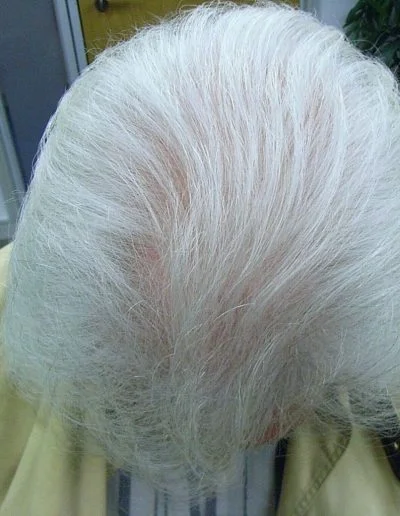 Giovanni Post Treatment 1