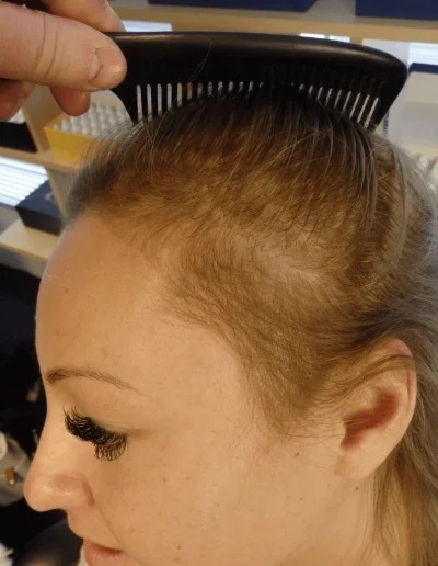 Hanna Diffuse Thinning Pre Treatment 2