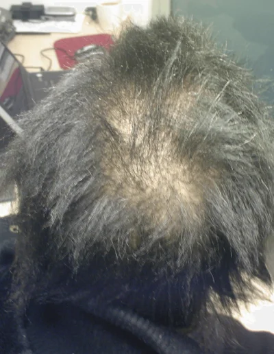 Hazel Black Hair Loss