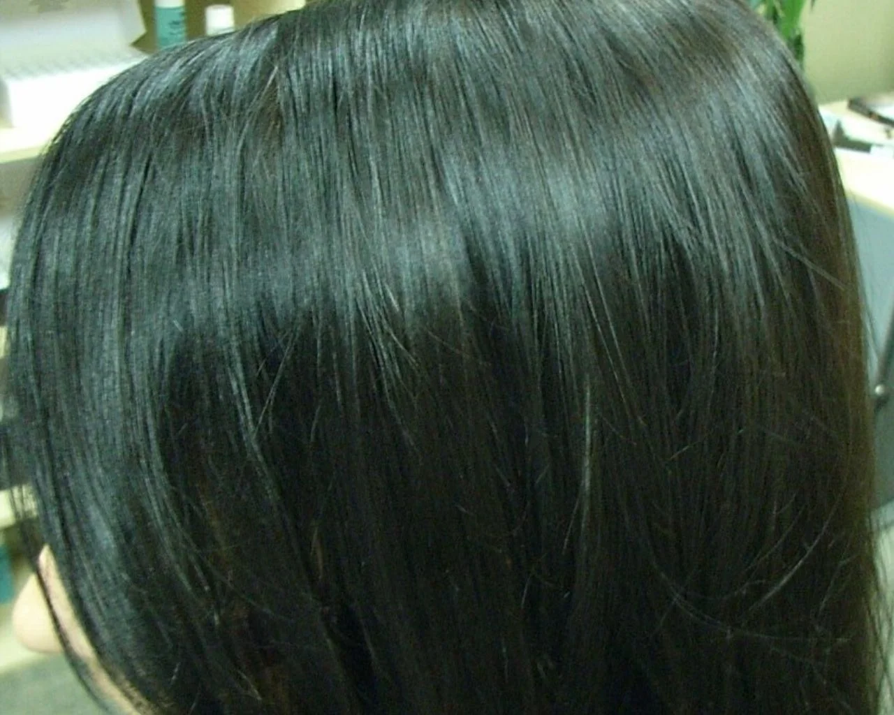 Nadia after treatment — Female Pattern Balding