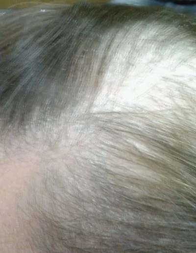 14 Before