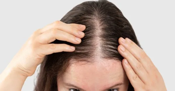 Telogen Effluvium treatment results in Aberdeen