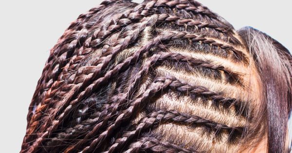 Traction Alopecia treatments